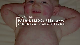 PÁTÁ NEMOC Fifth disease  Erythema infectiosum Inkubační doba typické příznaky a léčba [upl. by Valery]