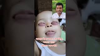 এই শিশুটি দেখুন কতই না আজব দেখতে আপনারা সবাই তার জন্য দোয়া করবেন baby cutebaby live like [upl. by Ryhpez]