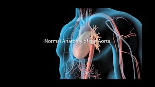 Aortic Aneurysm and Aortic Dissection [upl. by Ihsoyim171]