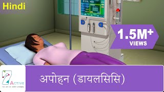 अपोहन डायलिसिस  DIALYSIS  Hindi [upl. by Llebyram]