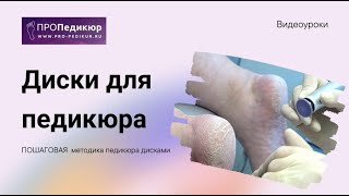 Диски для педикюра Как делать педикюр дисками при гиперкератозе диски педикюр гиперкератоз [upl. by Ajssatan658]