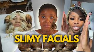 WHY Snail Facials Could be GREAT FOR SKIN [upl. by Nacul]