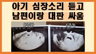 시험관 임신기록6주차 럭키 심장소리 듣고 왔어요국민행복카드 바로 쓰기 전에 확인해보세요 [upl. by D'Arcy119]