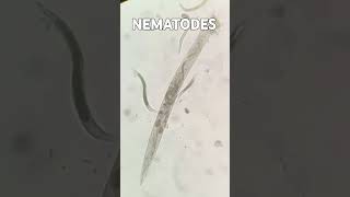 Nematodes  Agriculture  Nematology nematodes Nematology agriculture viralshort viralshorts [upl. by Pevzner]