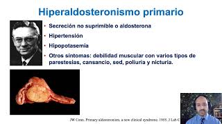 Hiperaldosteronismo primario [upl. by Okimuy]