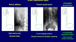 Intravenous Urography basics [upl. by Hazard885]