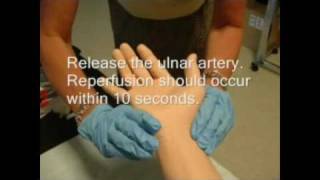 Arterial Blood Gas Sampling Procedure [upl. by Ataeb]