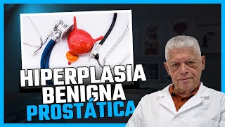 Como tratar a Hiperplasia Benigna da Próstata [upl. by Ityak343]