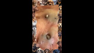 Blackhead Removal  18  Blackhead extraction  blackheads [upl. by Siramed]