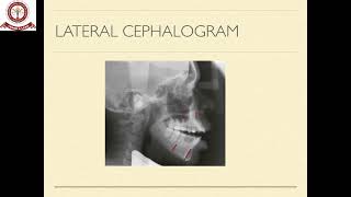 Orthognathic surgery [upl. by Cami306]