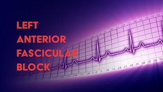 Left Anterior Fascicular Block  How to Read an Electrocardiogram EKG  MEDZCOOL [upl. by Oileduab830]