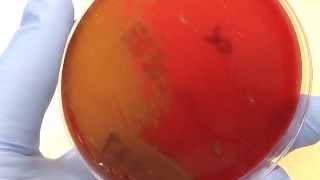 Microbiology  Hemolysis [upl. by Strage]