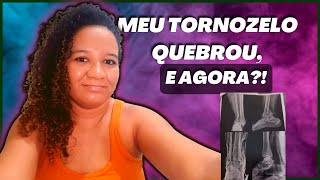 TORNOZELO QUEBRADO  MEU RELATO fratura trauma tornozelo [upl. by Hallvard]