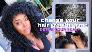 Why Detoxing Your Scalp amp Natural Hair Is A MUST  Hair Growth  Melissa Denise [upl. by Treva]