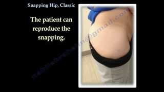 Snapping Hip Classic  Everything You Need To Know  Dr Nabil Ebraheim [upl. by Shaw]