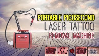 Portable PICOSECOND LASER Tattoo Removal Machine RED [upl. by Spevek]