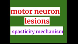 motor neuron lesion spasticity mechanism [upl. by Norahs]