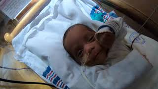 Premature baby born at 27 weeks amp 5 days 1lb 14oz [upl. by Notsgnik]