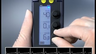 Sensing and Threshold Test — 53401 Temporary Pacemaker [upl. by Joung]