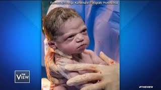 Newborn Baby’s Facial Expression Goes Viral  The View [upl. by Lalat]