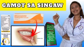 SINTOMAS DAHILAN AT GAMOT SA SINGAW SA BIBIG AT LABI  SINGAW SA BIBIG TREATMENT [upl. by Odlavso874]