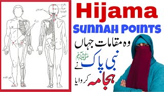 Hijama Sunnah Points  Wet Cupping  Hijama Benefits [upl. by Neenwahs]