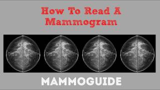 How To Read A Mammogram [upl. by Jezebel]