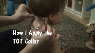 How to Apply TOT Collar used for Torticollis [upl. by Niatsirhc247]