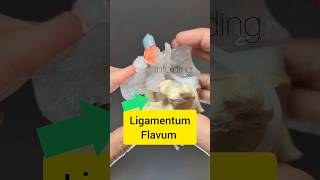 Ligamentum Flavum Modelling  Dynamic Disc Designs [upl. by Atinuahs]