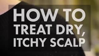 How to Treat a Dry Itchy Scalp  WebMD [upl. by Snider844]