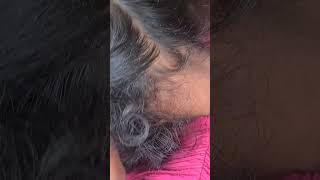 61free nits on hair hair haircare satisfying louse [upl. by Sirromaj]