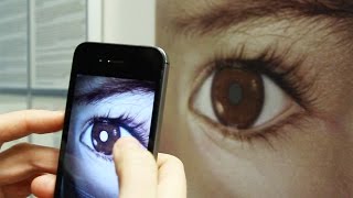 Detect Eye Cancer Retinoblastoma with Your Smart Phone – CHECT UK [upl. by Uttasta]