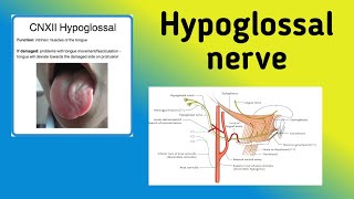 Hypoglossal Nerve  Cranial Nerve 12 Pathway Nerve Lesion [upl. by Kcirdnekal]