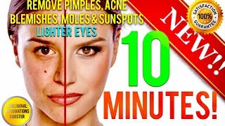 REMOVE DARK SPOTS BLEMISHES ACNE MOLES amp GET LIGHTER EYES IN 10 MINUTES SUBLIMINAL AFFIRMATIONS [upl. by Lucier]