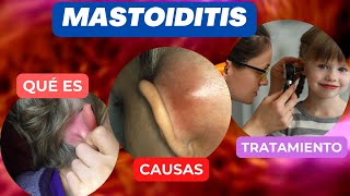 La mastoiditis  que es [upl. by Iramat970]