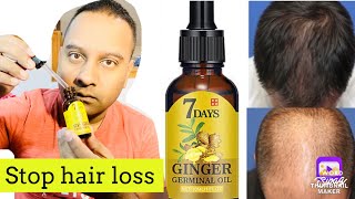 You Want Your Hair Back Use  7 DAYS GINGER germinal hair OIL with DERMA ROLLER [upl. by Auqenat]