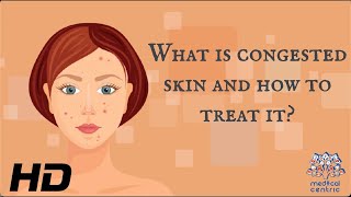 What Is Congested Skin And How To Treat It [upl. by Notnats590]