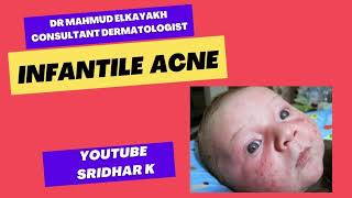 Infantile acnea dermatologists perspective rash newbornrash Infantileacne [upl. by Elahcim573]