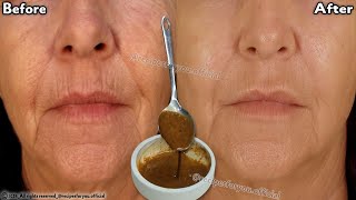 Facelift with natural collagen At 70 years Wrinkles disappear in 3 minutes coffee face pack [upl. by Eiryk]