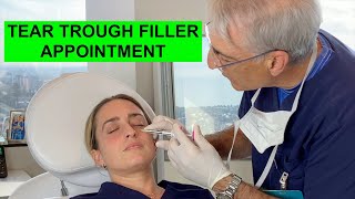 REAL PATIENTS REAL STORIES Dr A Gives Bridget Tear Trough Fillers for Tired Eyes [upl. by Vano]