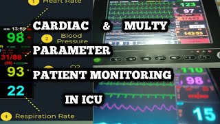 CARDIAC AND MULTI PARAMETERS PATIENTS MONITORING IN CRITICAL CARE UNITMEDICAL TECHNOLOGIST MT CCU [upl. by Gaye]