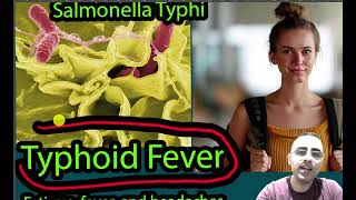 Typhoid Fever Symptoms Causes and treatment [upl. by Acirne]