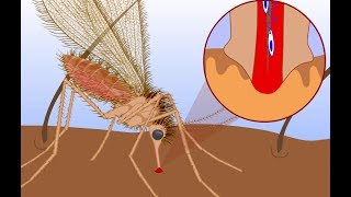 Leishmaniasis life cycle [upl. by Alegnad537]