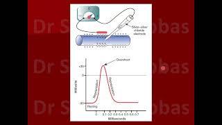 skeletal vs cardiac action potential [upl. by Leahcimrej]