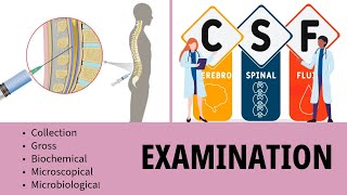 CSF Examination  Cerebrospinal Fluid  Collection  Gross  Biochemistry  Microscopy [upl. by Ecirtnom]