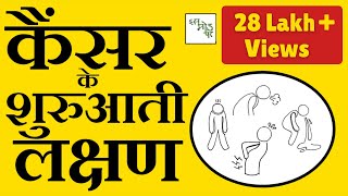 Common cancer signs Hindi Cancer Ke Shuruati Lakshan  Cancer early signs hindi [upl. by Anomar758]