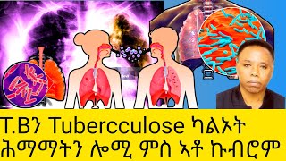 TBን Tubercculose ካልኦት ሕማማትን ሎሚ ምስ ኣቶ ኩብሮም [upl. by Beverley]