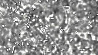 Semen sperm cells under the microscope at 400x [upl. by Arihs635]