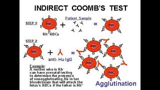 Indirect Coomb Test ICT [upl. by Petronella]