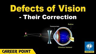 Defects of Vision and Their Correction Myopia And Hypermetropia [upl. by Sklar204]